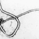 An electron micrograph of the Ebola virus.